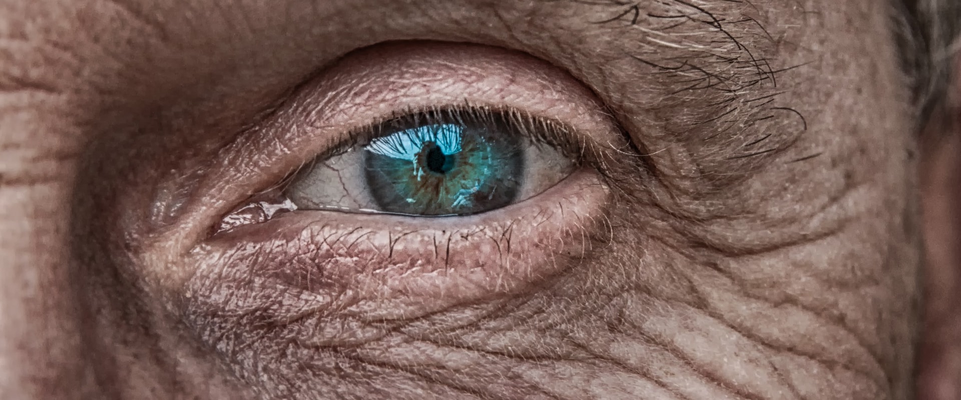 what-are-the-risks-of-bending-over-after-cataract-surgery