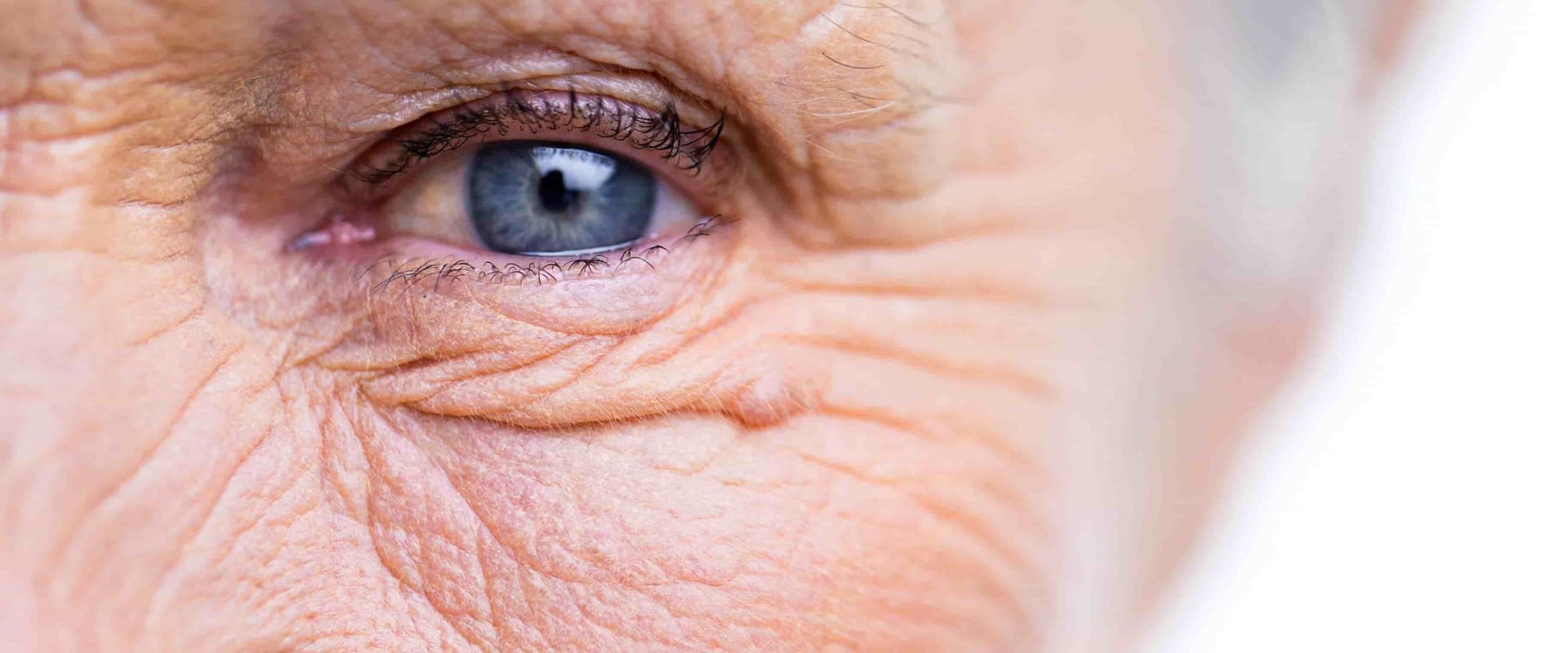 what-to-avoid-after-cataract-surgery-6-tips-for-a-quick-recovery