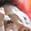 What to Do and Not Do After Cataract Surgery